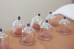 Cupping - a suction technique to pull toxins build