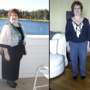 Arlene R. - 55-pound weight loss!
