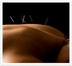 acupuncture uses very fine needles that are relati