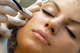 Microdermabrasion facials improve age spots, bleni