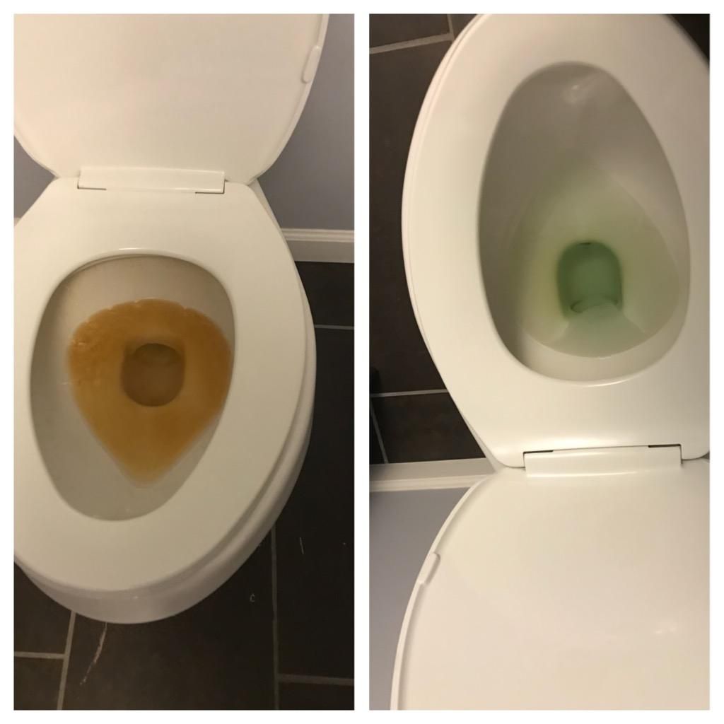 Deep Stain removal 