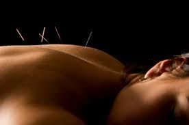 Acupuncture at its best
