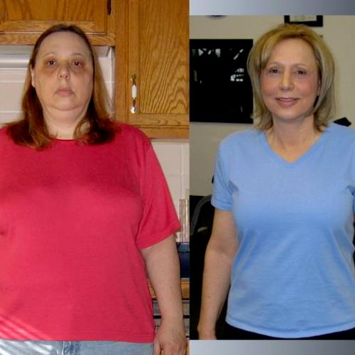 Beth lost 86lbs in 1 year!