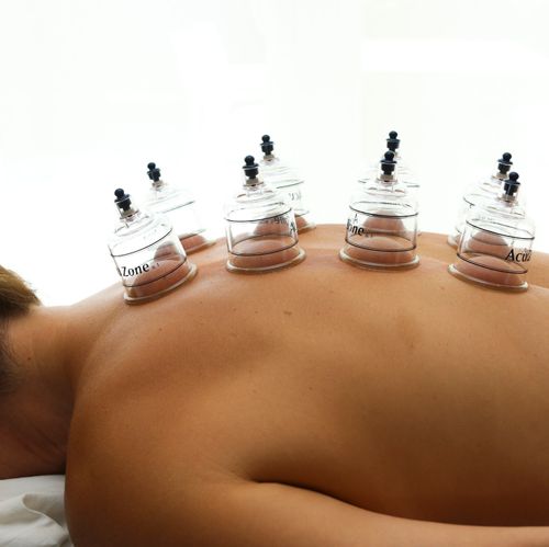 Cupping to improve circulation and release muscle 