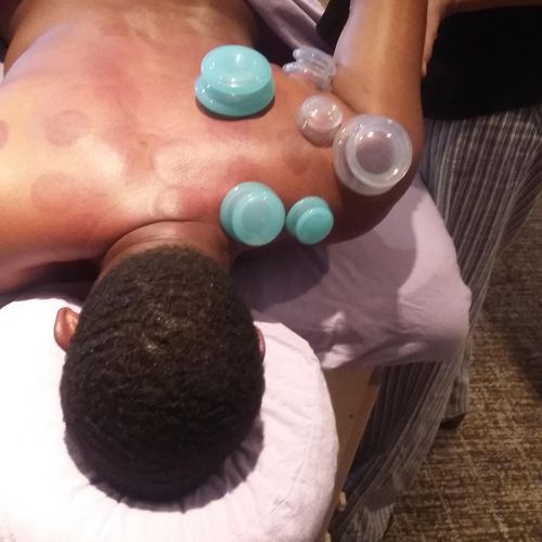 Cupping and stretching on the shoulder. It feels A