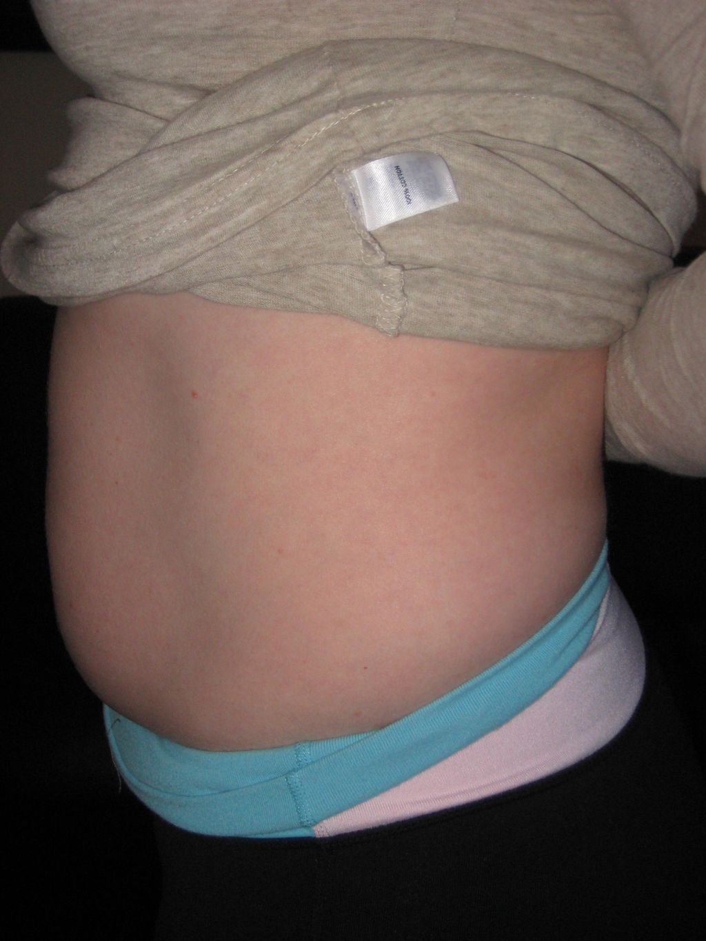BEFORE diastasis recti rehab with Abby