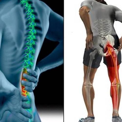Do you have lower back or sciatic pain causing you