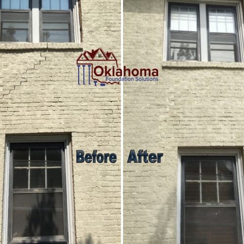 Before and After (Two Story) - OFS