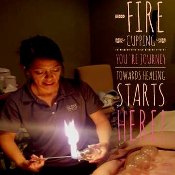 Fire Cupping