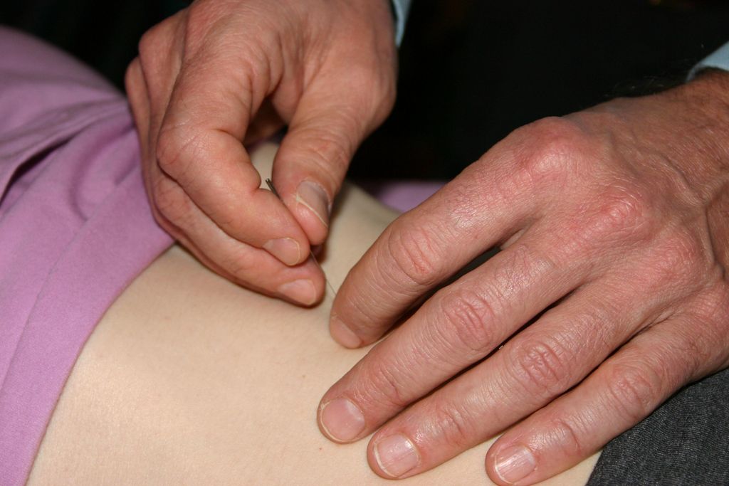 Application of non-insertive acupuncture. The need