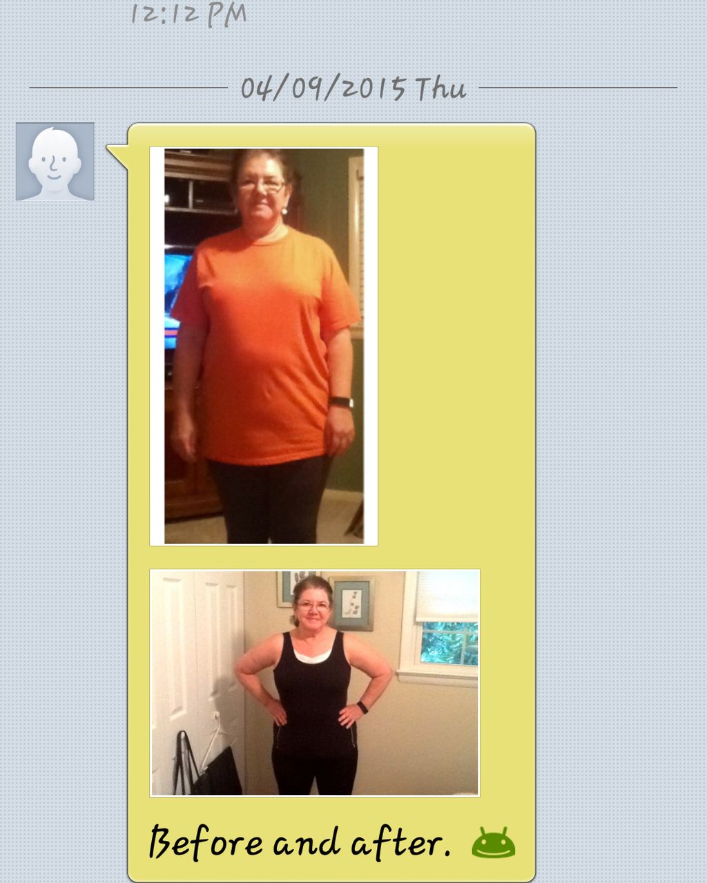 Another before and after!