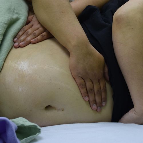 Belly massage on prenatal client.