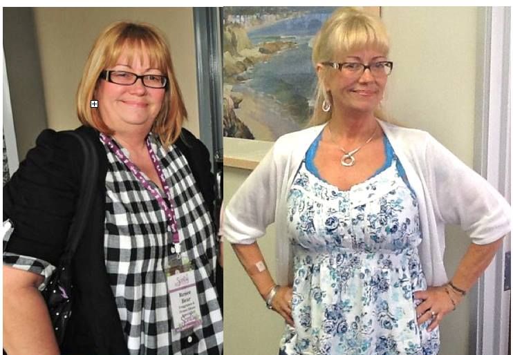 Renee lost 70 pounds - people who hadn't seen her 