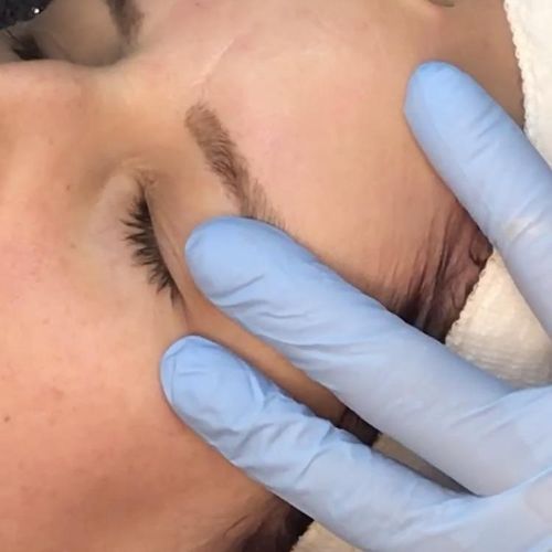 Dermaplaning takes your face from dull and dry to 