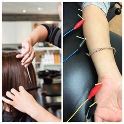 The use of a thin filiform needle requiring skille