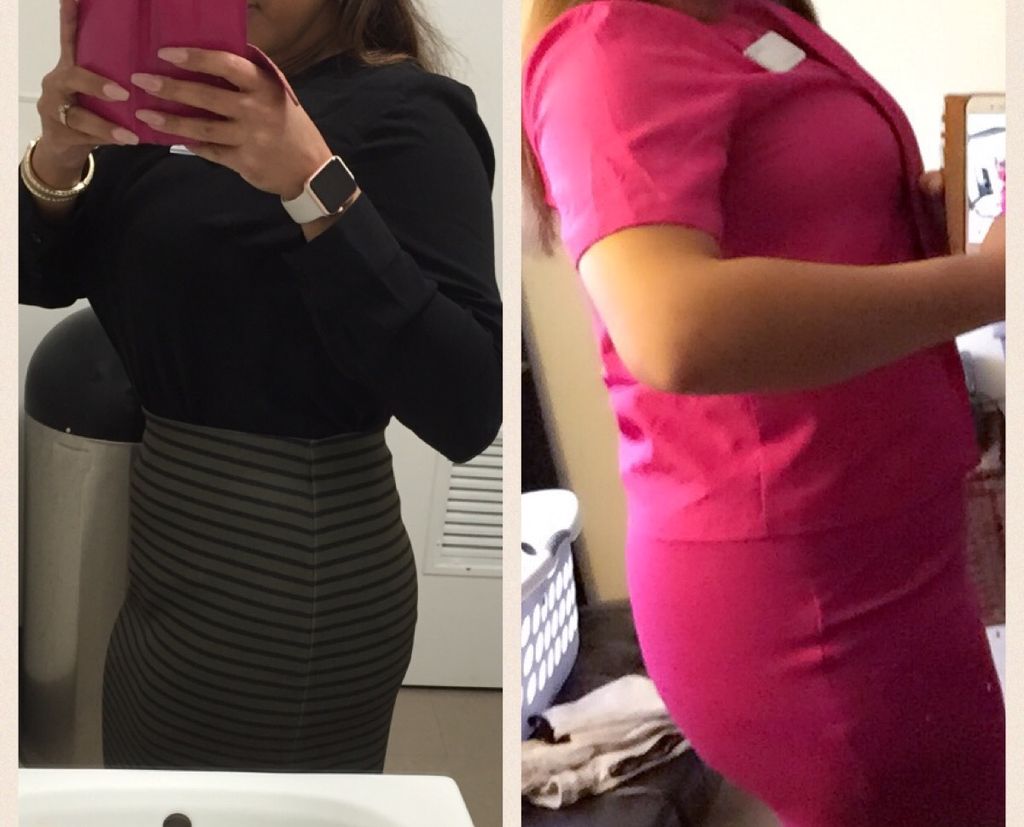 One month after being diagnosed PCOD 
