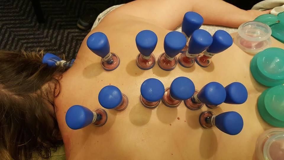 Cupping therapy using Baguanfa Cups & Haci Cups.