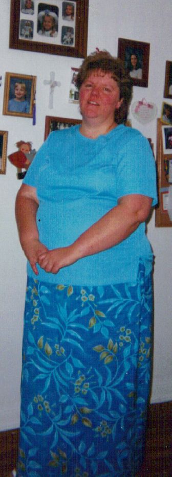 A photo of me before Gastric Bypass and hypnosis.