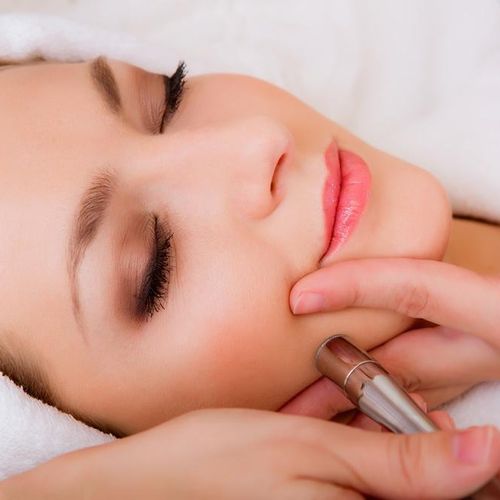 Microdermabrasion treatments are essential to keep
