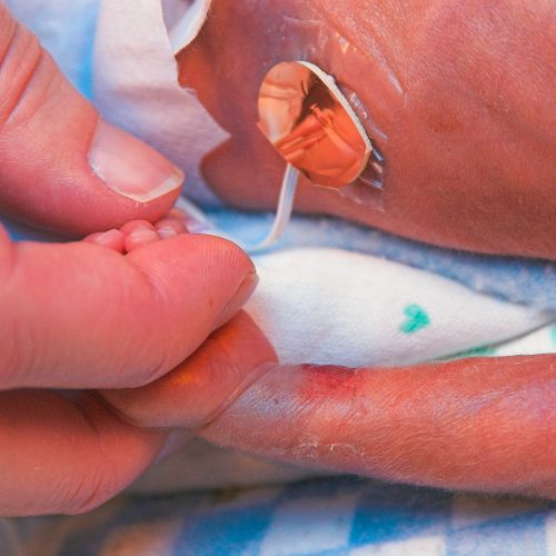 A premature baby holds his father's hand in the Ne