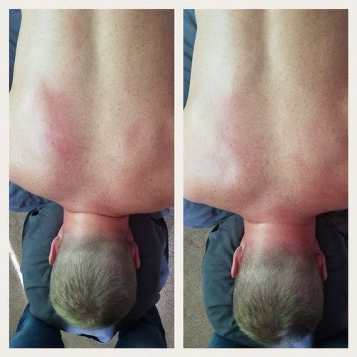 Before and After 2hr deep tissue massage