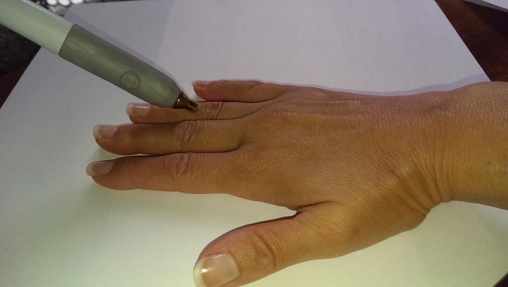 EAV test, Electro-dermal Acupuncture (no needles) 