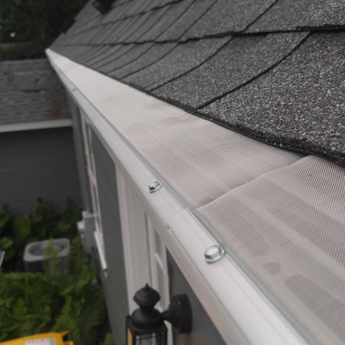 Gutter Dome features a surgical grade stainless st