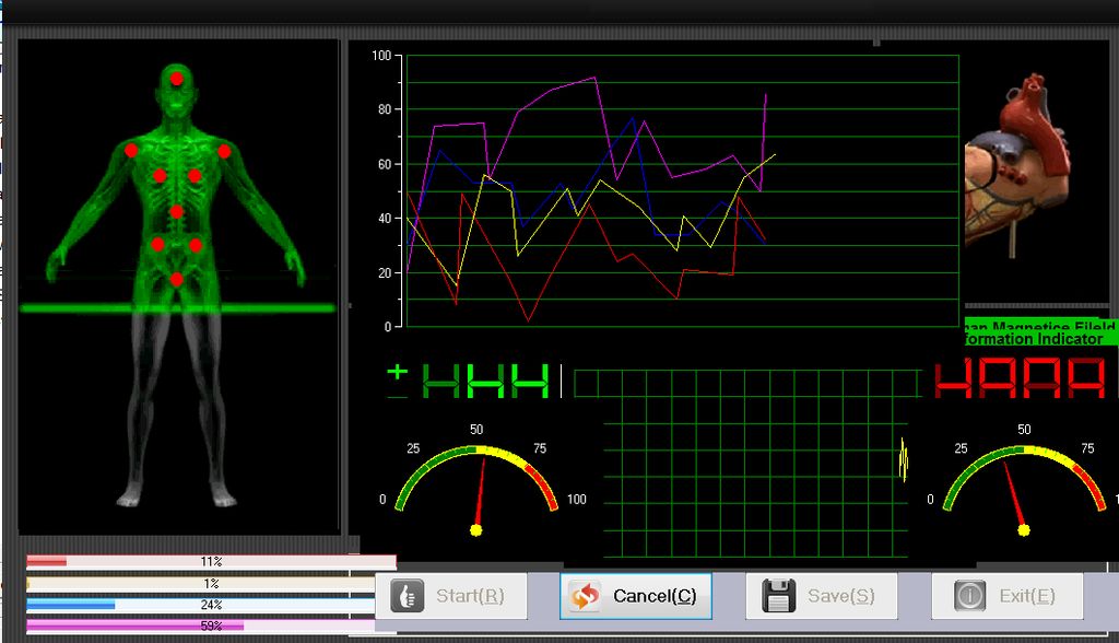 BIOFEEDBACK
The Biofeedback is an non evasive test