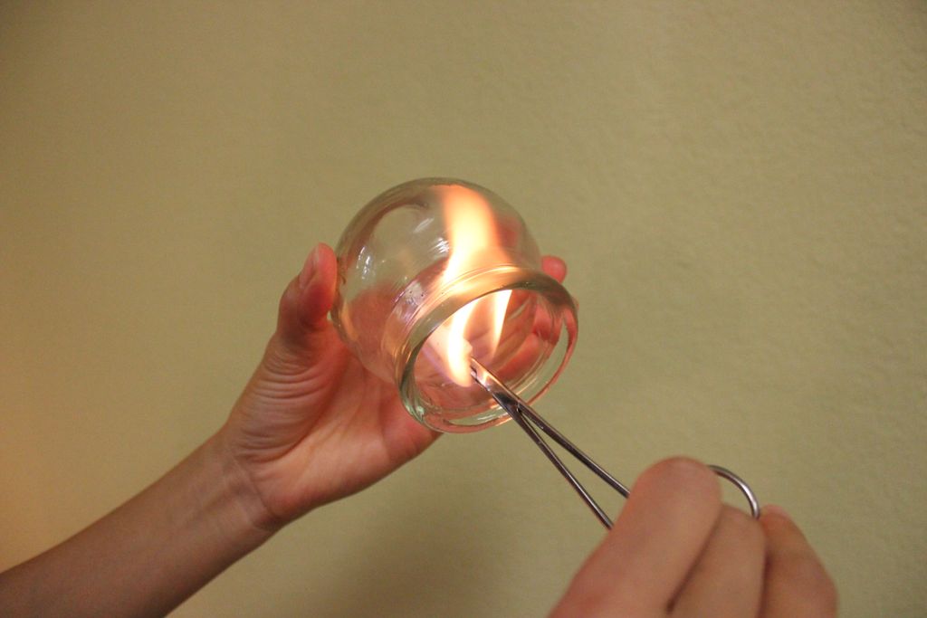 Ask us about the benefits of fire cupping!