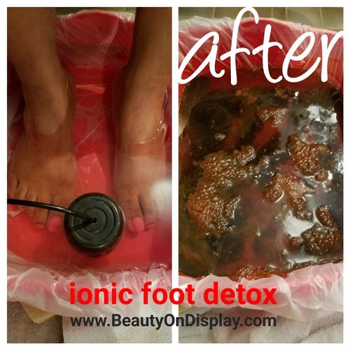 Before/after Ionic Foot Detox to rid the body of h