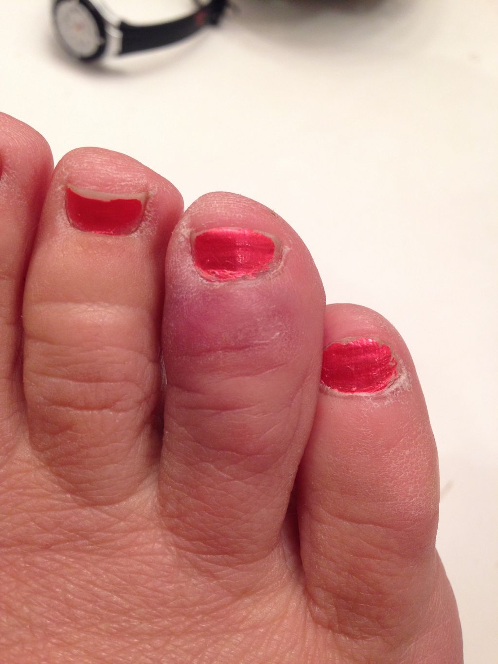 Try to take pictures of your injuries too - even i