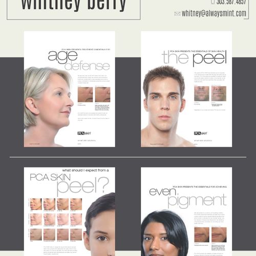 Posters for skincare & chemical peel company