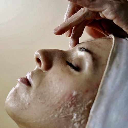 Acne is one of the skin conditions treated.