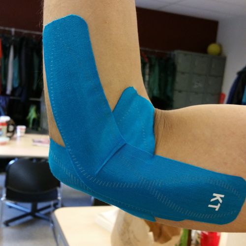 an example of taping "golfers" elbow. Client recei