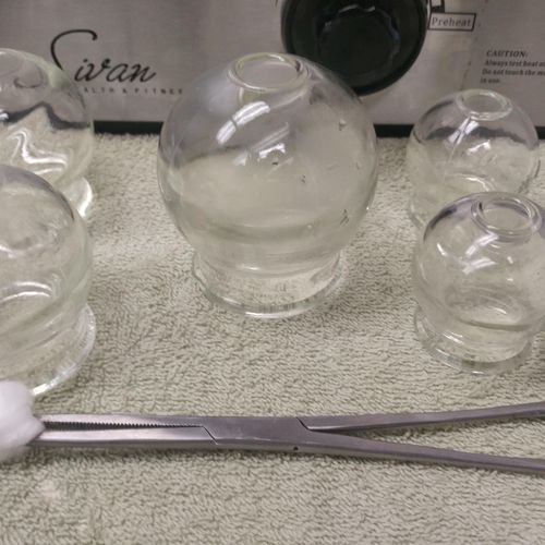 Cupping Treatment 