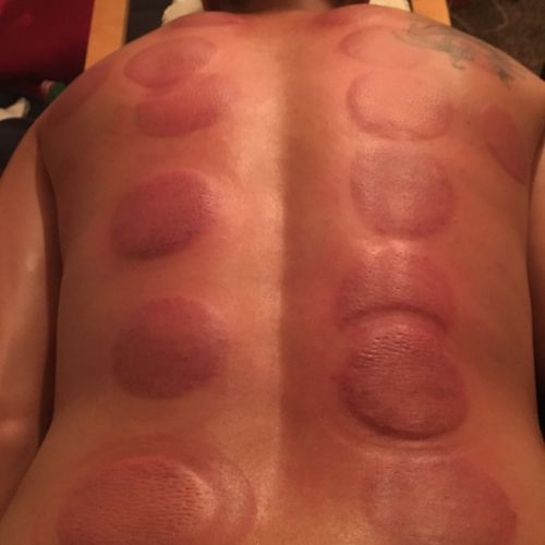I've had cupping and a Thai massage from Jeremiah 