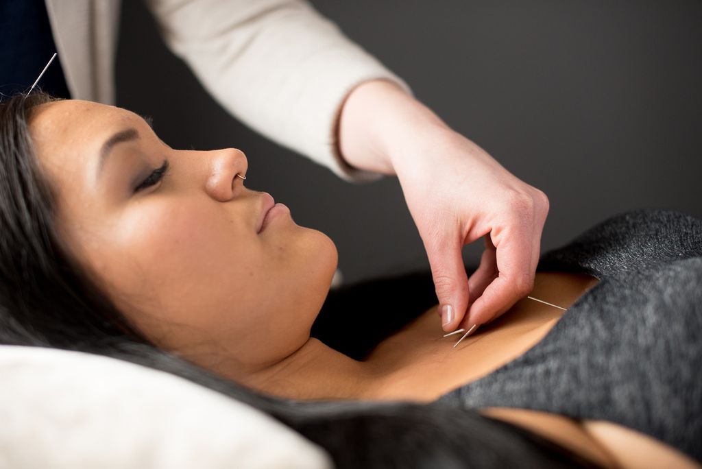 Acupuncture treatments are peacaceful and relaxing