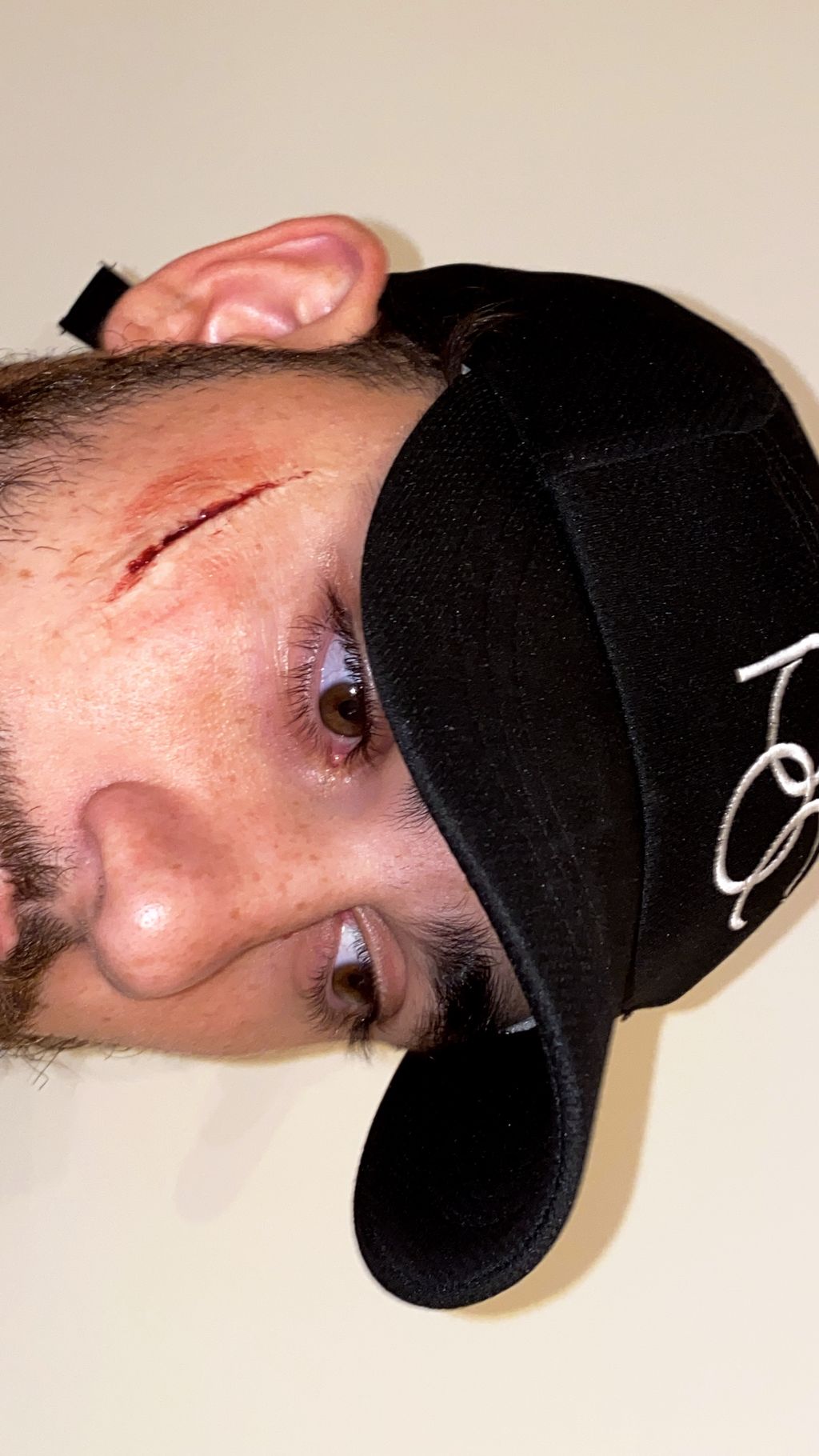 Open wound injury with special effects 