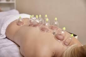 Cupping Massage Treatment Ancient chinese therapy 