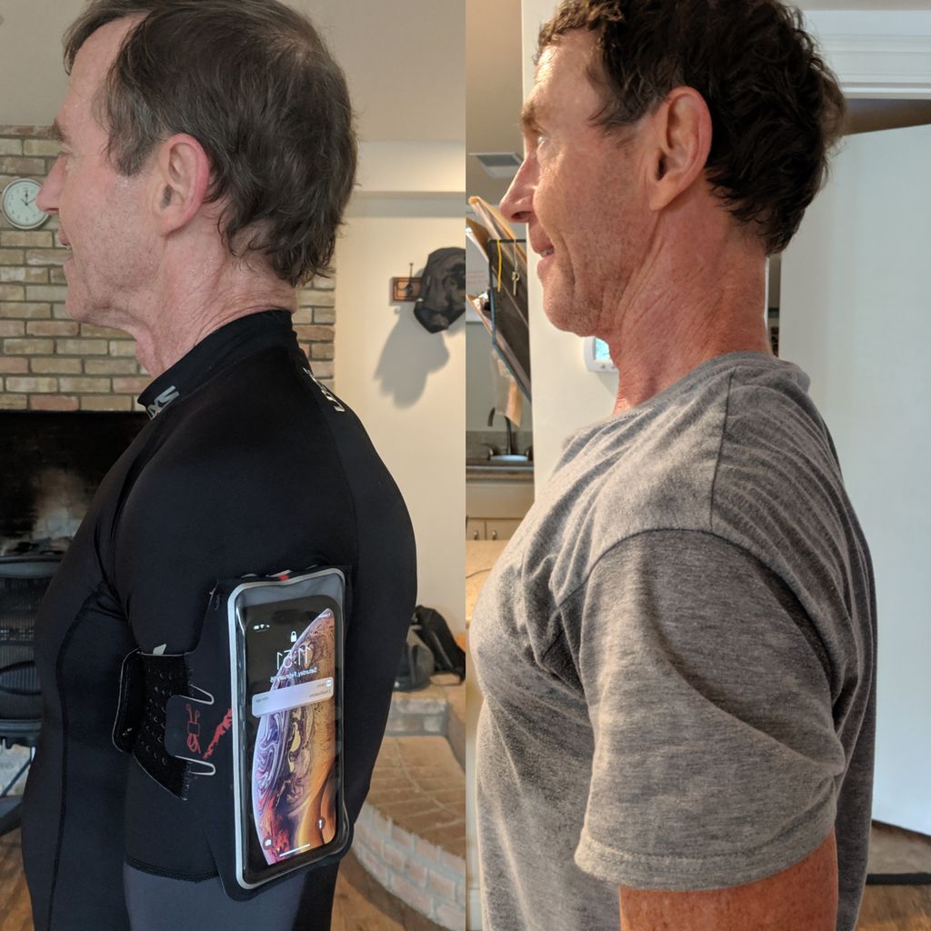 Postural Correction Client, this is a Before and A