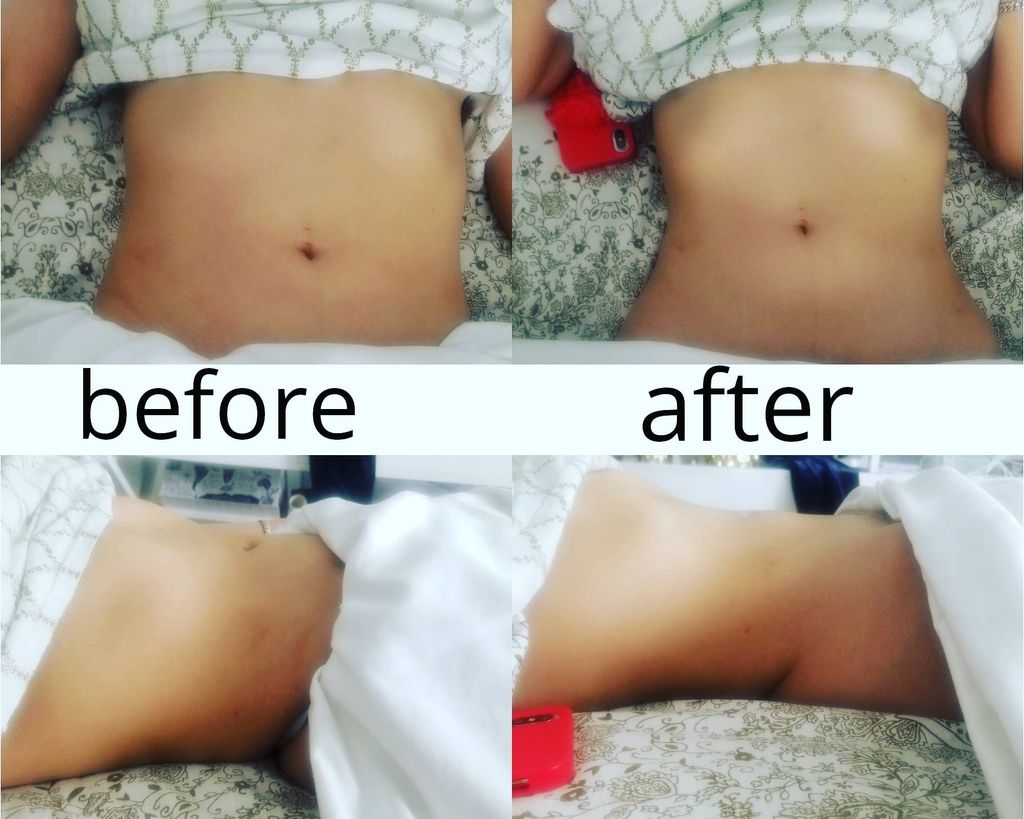 LYMPHATIC drainage massage by me😁