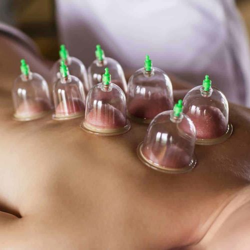 Cupping massage available 