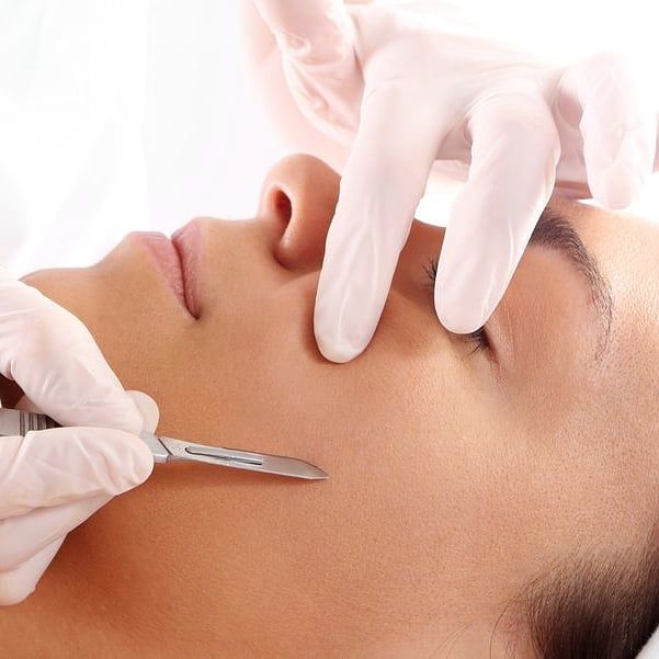 Dermaplaning