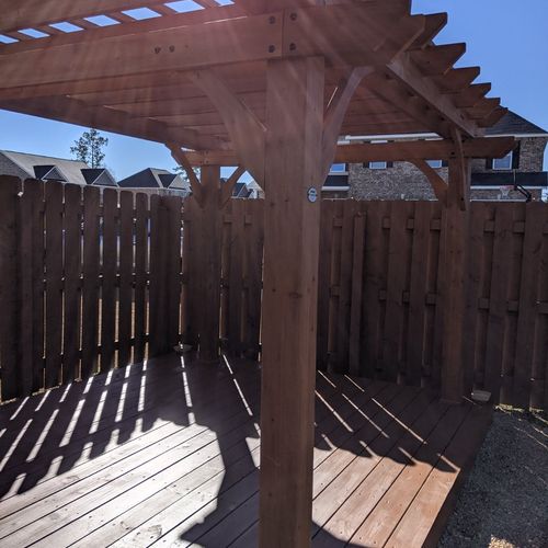 I had a pergola installed with a deck build. Very 