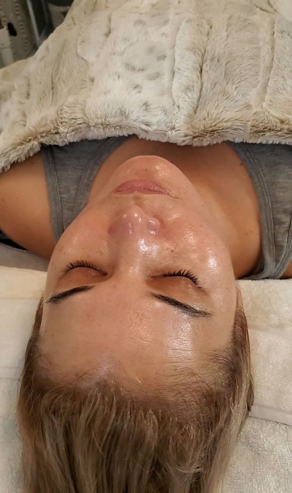 Post Facial Glow 🌟🌟
