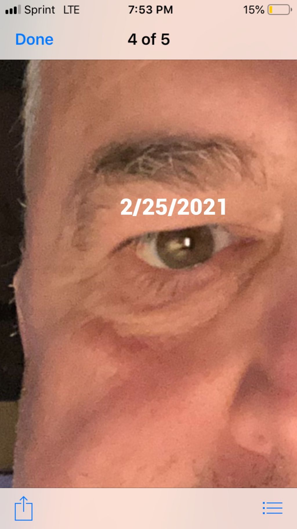 After (dissipated wrinkles)