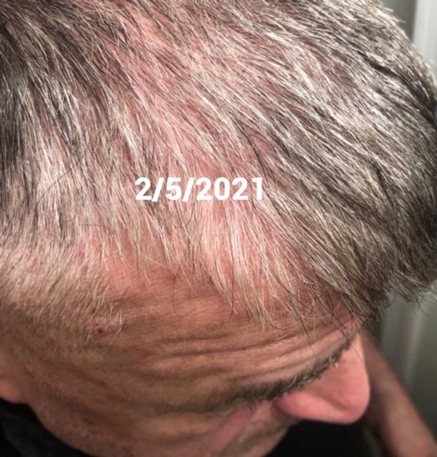 Before (thinning & bristled)