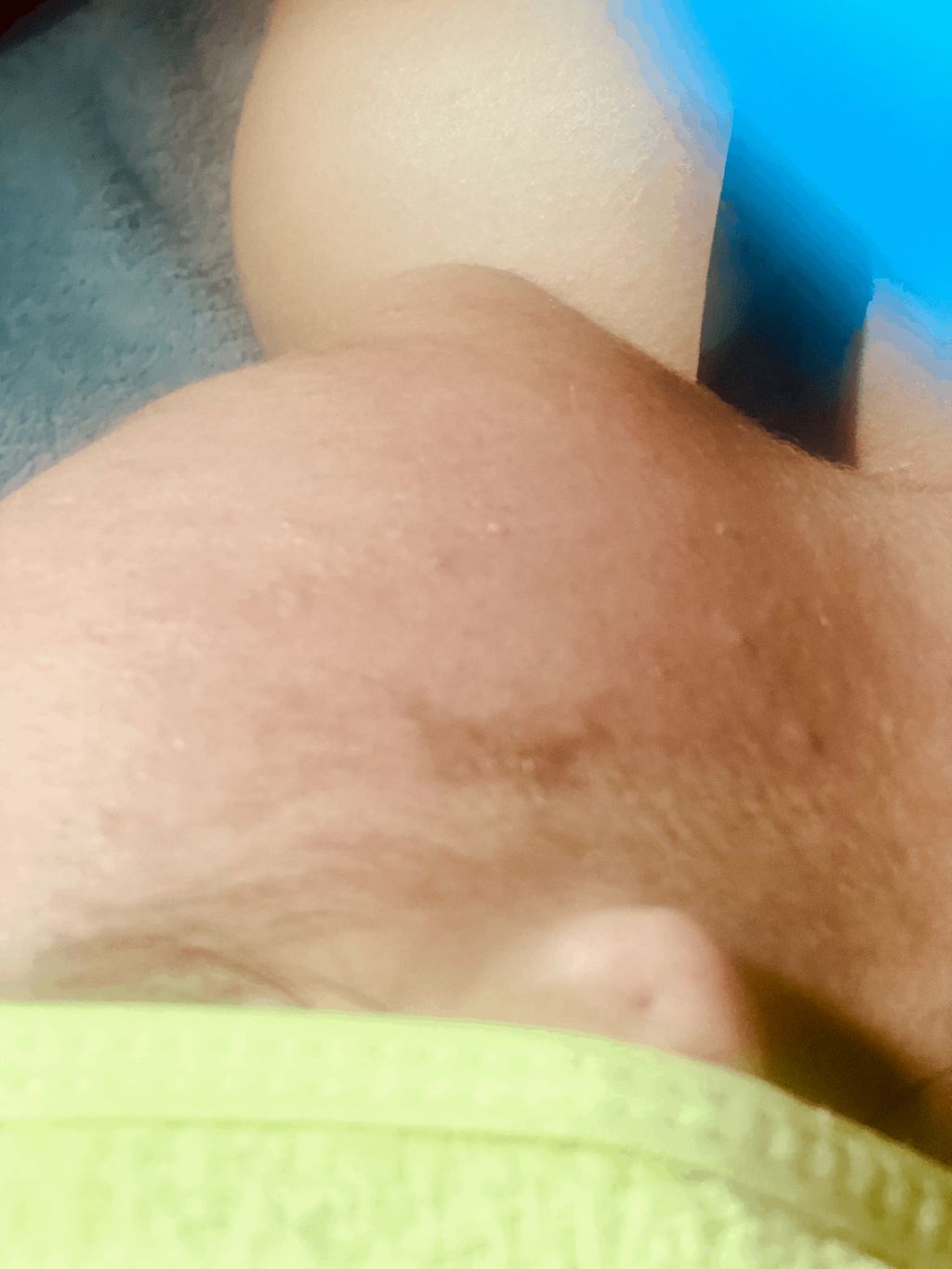 Dermaplaning