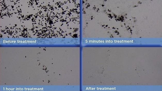 Before and after treatment