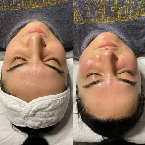 Before (left) & After (right) of my Signature Plump facial. 
